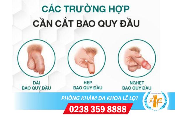 Cac-truong-hop-can-cat-bao-quy-dau