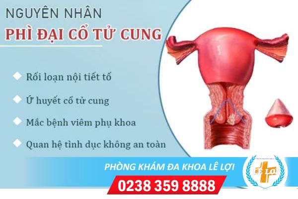 Nguyen-nhan-gay-phi-dai-co-tu-cung-o-nu-gioi-la-do-dau