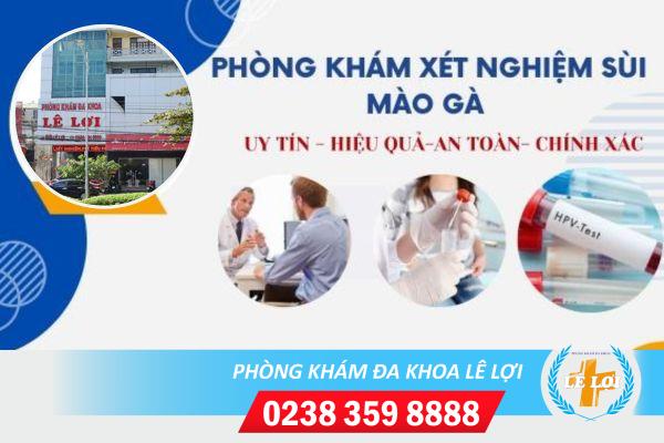 Cach-xet-nghiem-sui-mao-ga-hieu-qua-hien-nay-1