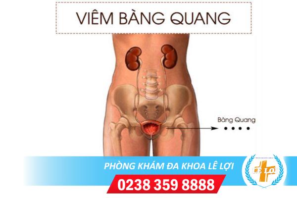 Viem-bang-quang