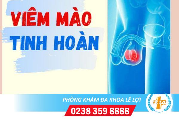 Viem-mao-tinh-hoan