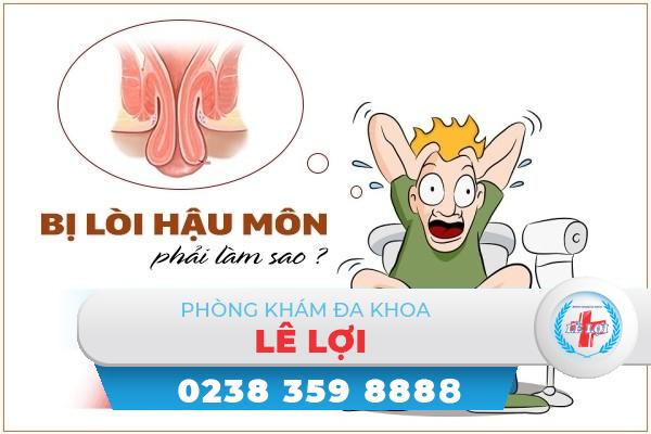 Bị lòi hậu môn phải làm sao?