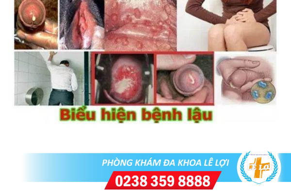 Nội Dung đoạn Văn Bản Của Bạn (1)