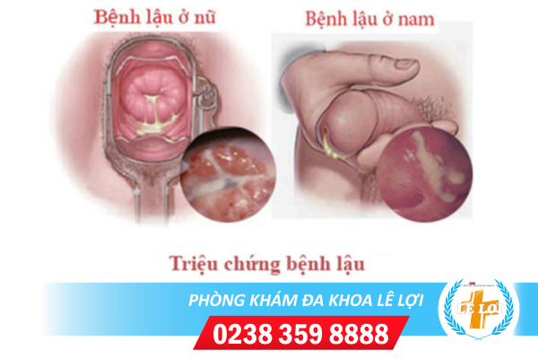 Nội Dung đoạn Văn Bản Của Bạn (3)