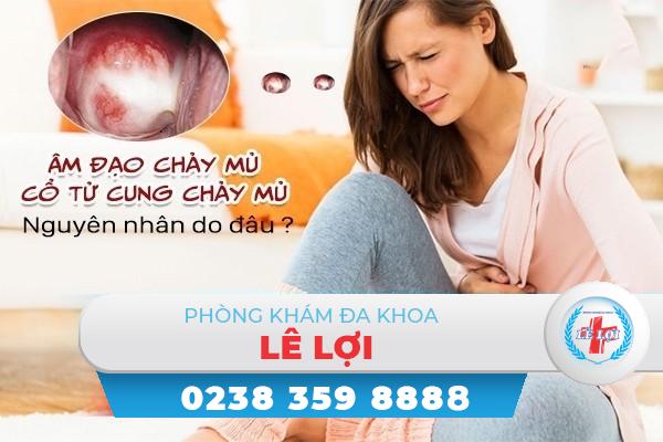 Âm đạo chảy mủ, cổ tử cung chảy mủ nguyên nhân do đâu, cách chữa thế nào?