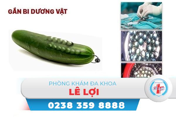 Gắn bi dương vật cải thiện kích thước