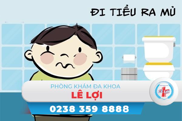 Tiểu ra mủ dấu hiệu bệnh không nên chủ quan