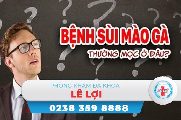 Bệnh sùi mào gà thường mọc ở đâu?