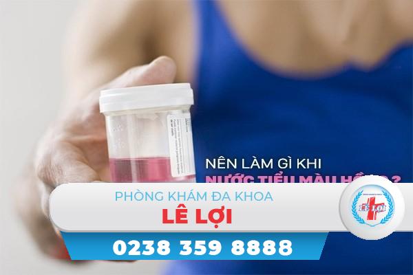 Nên làm gì khi nước tiểu màu hồng?