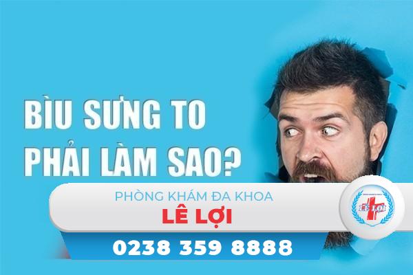 Phát hiện bìu sưng to - Đây là đều cần nên làm