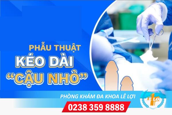 Phau-thuat-keo-dai-cau-nho-nhu-the-nao