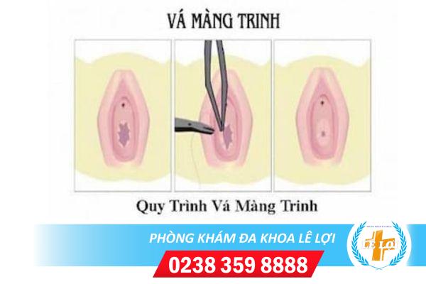 Va-mang-trinh