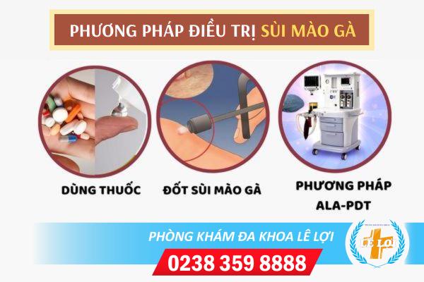 Phuong-phap-dieu-tri-sui-mao-ga-an-toan-hieu-qua-1