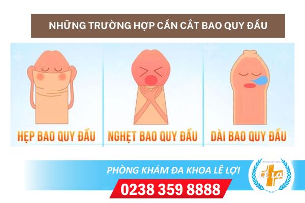 Nhung-truong-hop-can-cat-bao-quy-dau