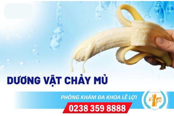 Duong-vat-chay-mu