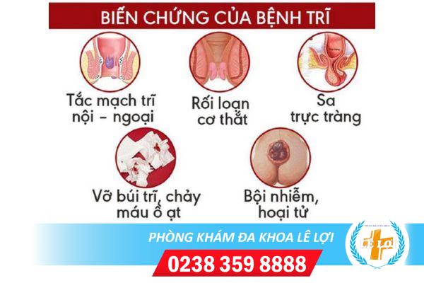 Bien-chung-benh-tri