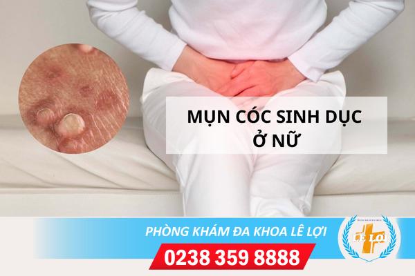 Mun-coc-sinh-duc-o-nu