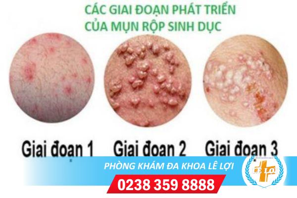 Di-massage-bi-lay-benh-gi-dau-hieu-nhan-biet-1