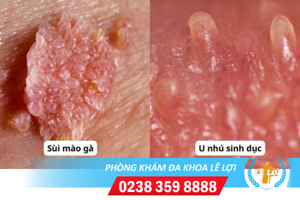 Thiết Kế Chưa Có Tên (52)