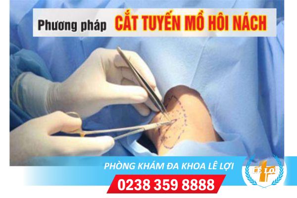 Cat-tuyen-mo-hoi-nach-co-hieu-qua-khong