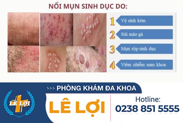 Noi-mun-sinh-duc-nam-nu