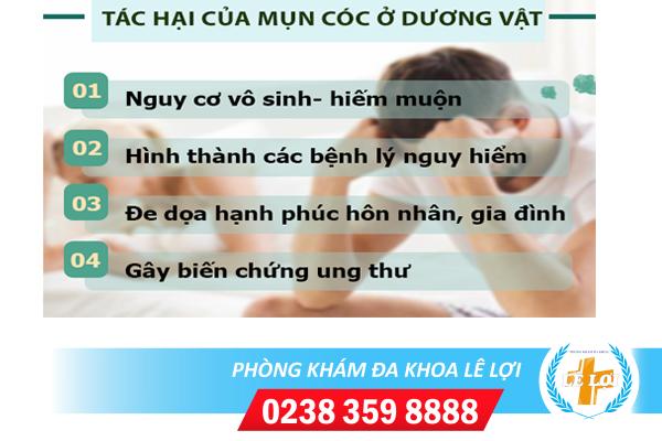 Bi-mun-coc-o-duong-vat-phai-lam-sao