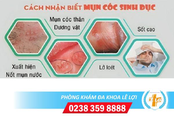 Dot-mun-coc-dau-khong-hieu-qua-khong-1