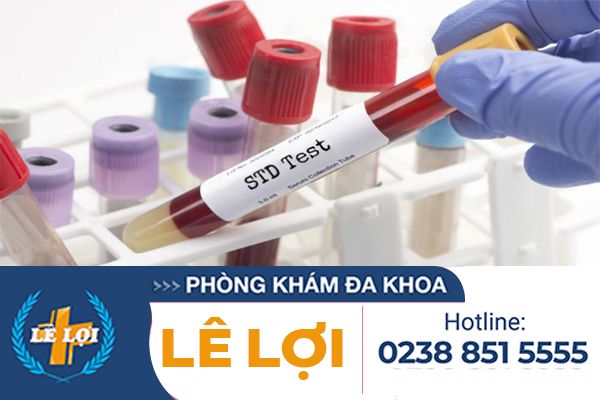 Xet-nghiem-benh-xa-hoi-cach-nao