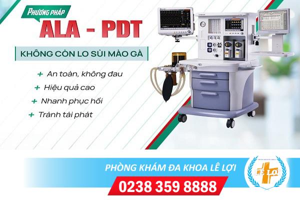 Phuong-phap-ala-pdt