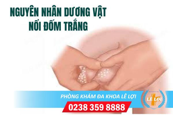 Duong-vat-noi-dom-trang